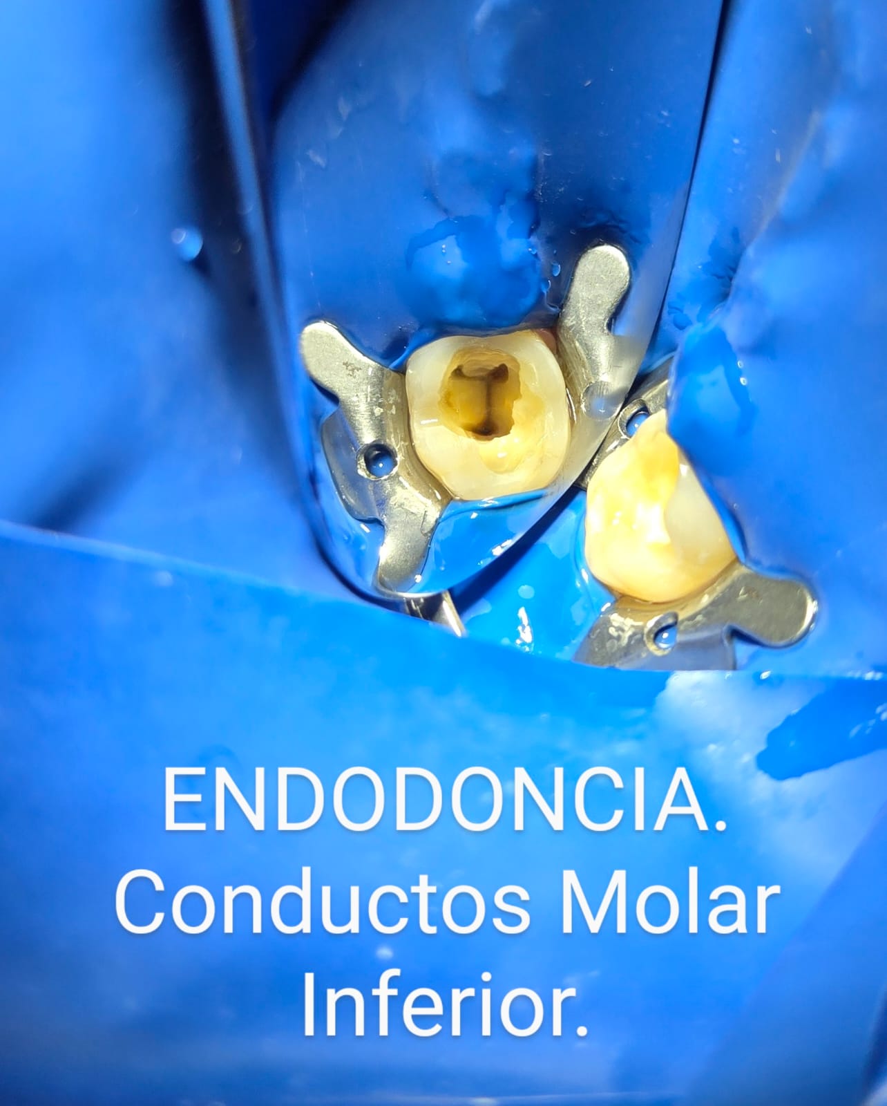 Consultorio de Especialidad Dental en Tlalpan CDMX